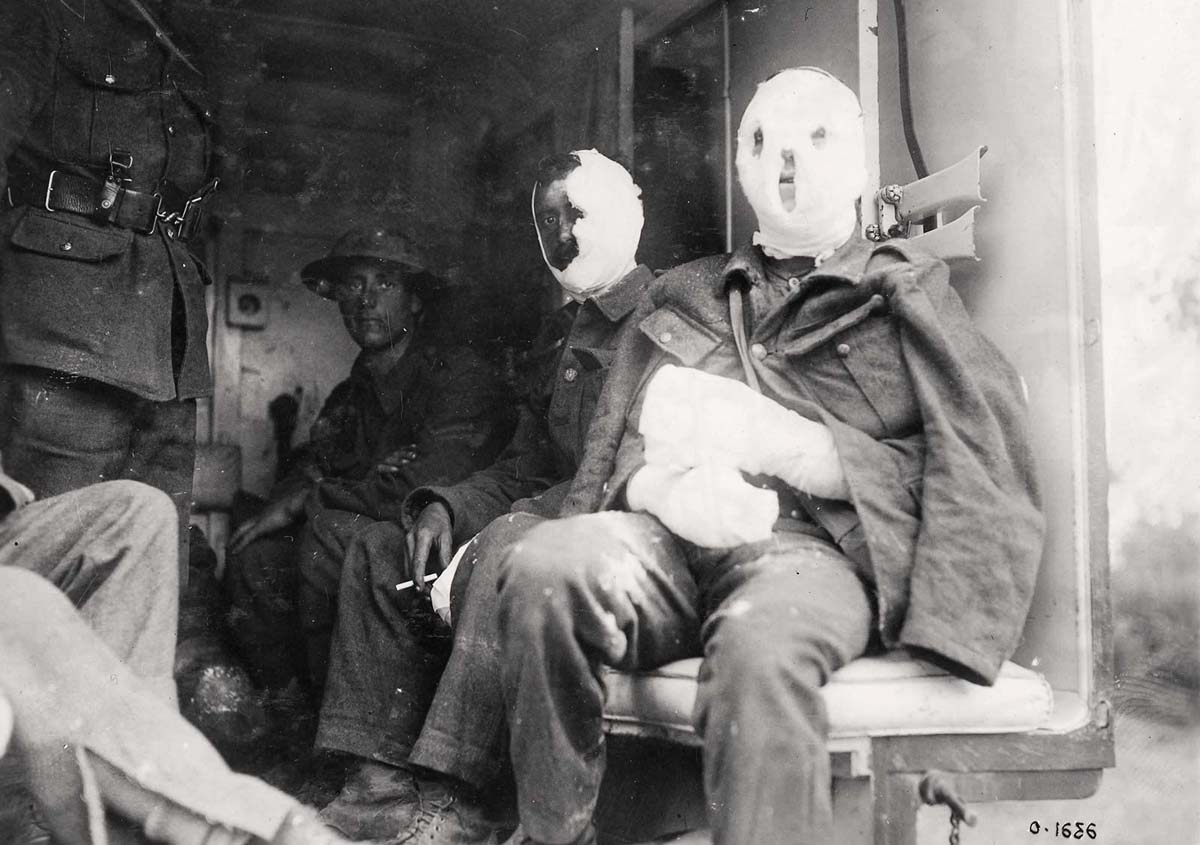 Soldats couverts de bandages blessés par des lance-flammes ou le gaz moutarde. Le gaz moutarde brûlait la peau et les poumons défigurant un grand nombre de soldats. © Musée canadien de la guerre
